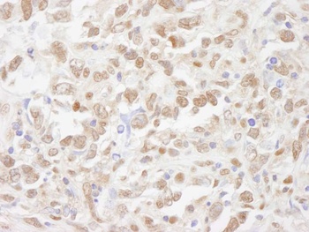 Rabbit TRIP1/SUG1 Antibody