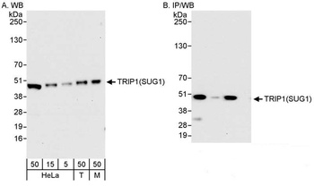 Rabbit TRIP1/SUG1 Antibody