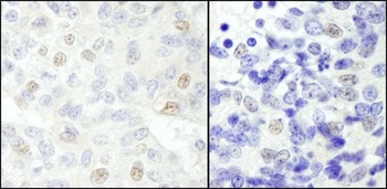 Rabbit NCOA62 Antibody