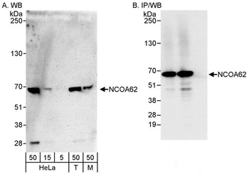 Rabbit NCOA62 Antibody