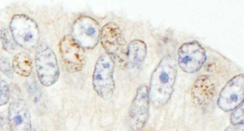 Rabbit NCOA62 Antibody