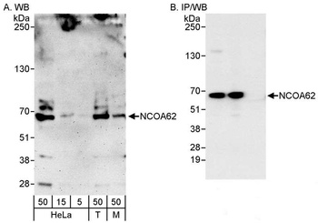 Rabbit NCOA62 Antibody