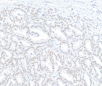 Rabbit MED12 Antibody