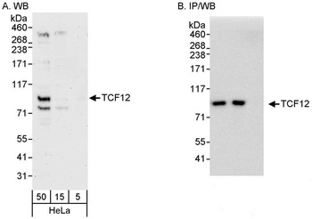 Rabbit TCF12 Antibody