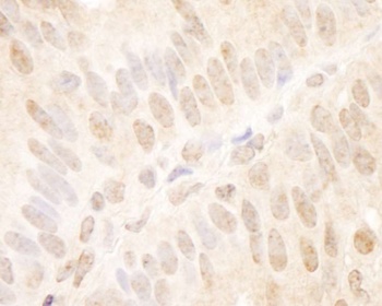 Rabbit TCF12 Antibody