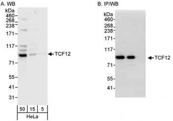 Rabbit TCF12 Antibody