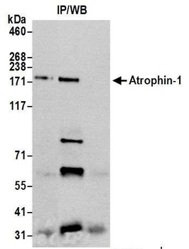 Rabbit Atrophin 1 Antibody