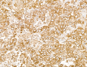 Rabbit RPL7 Antibody