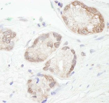 Rabbit UBCH7 Antibody