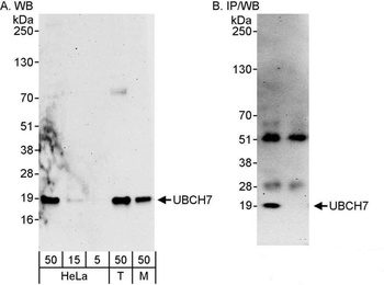 Rabbit UBCH7 Antibody