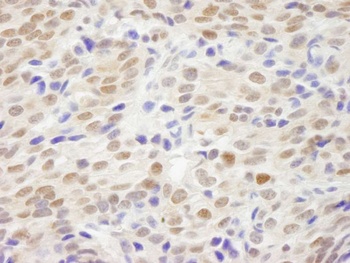 Rabbit XLF Antibody
