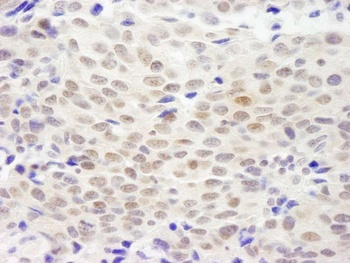 Rabbit XLF Antibody