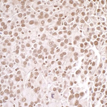 Rabbit anti-PRMT1 Antibody