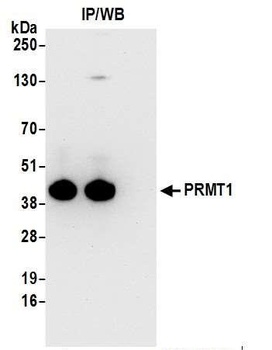 Rabbit anti-PRMT1 Antibody
