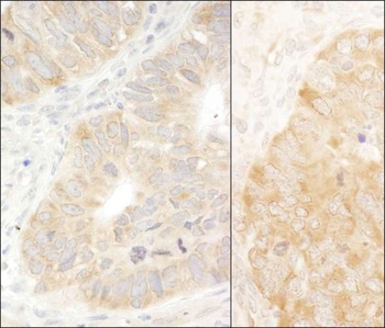 Rabbit eIF2alpha/EIF2S1 Antibody