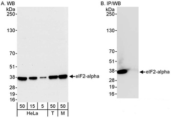 Rabbit eIF2alpha/EIF2S1 Antibody