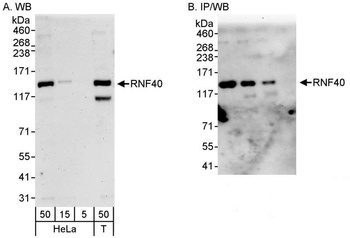 Rabbit RNF40 Antibody