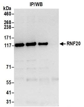 Rabbit RNF20 Antibody