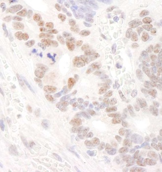 Rabbit DDX24 Antibody