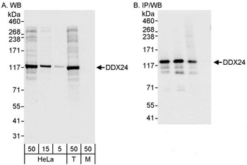 Rabbit DDX24 Antibody