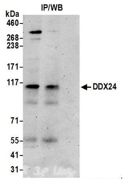 Rabbit DDX24 Antibody