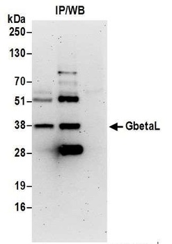 Rabbit GbetaL Antibody