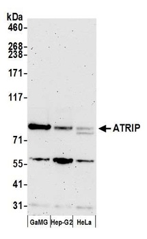 Rabbit ATRIP Antibody
