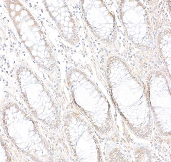Rabbit PARP10 Antibody