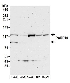 Rabbit PARP10 Antibody