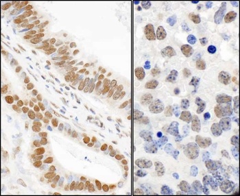 Rabbit Phospho 53BP1 (S25) Antibody