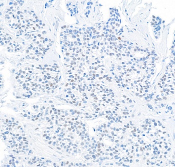 Rabbit DEC1 Antibody