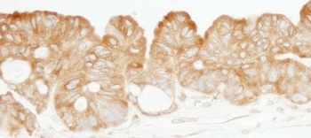Rabbit KARS Antibody