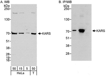 Rabbit KARS Antibody