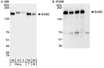 Rabbit ErbB2 Antibody