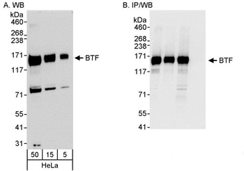 Rabbit anti-BTF Antibody