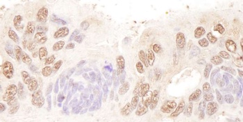 Rabbit BTF Antibody