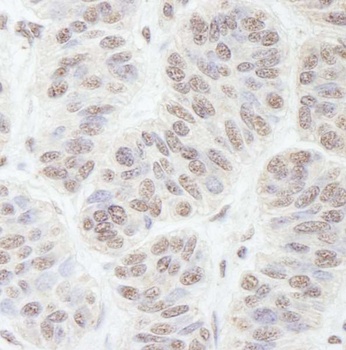 Rabbit anti-GNL3 Antibody