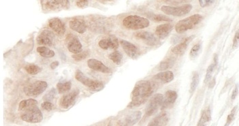Rabbit AF9 Antibody