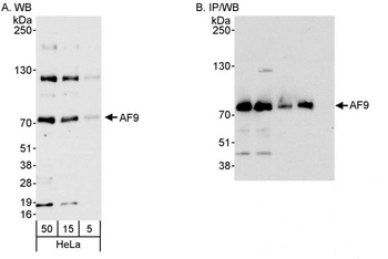 Rabbit AF9 Antibody