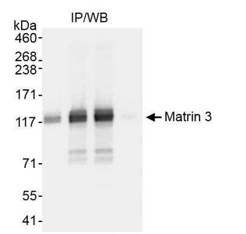Rabbit Matrin 3 Antibody