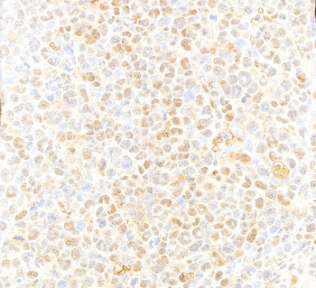 Rabbit anti-VCP Antibody
