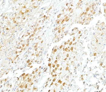 Rabbit anti-VCP Antibody
