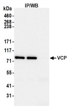 Rabbit anti-VCP Antibody