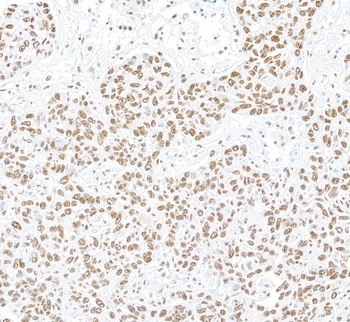 Rabbit NONO Antibody