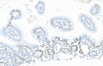 Rabbit NONO Antibody