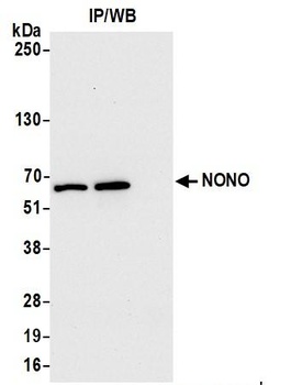 Rabbit NONO Antibody