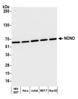 Rabbit NONO Antibody