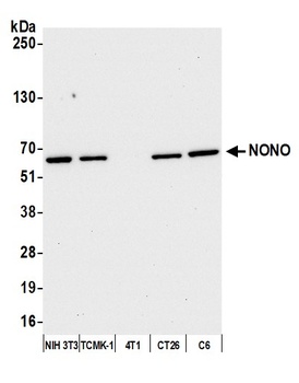 Rabbit NONO Antibody