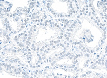 Rabbit NONO Antibody