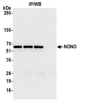 Rabbit NONO Antibody